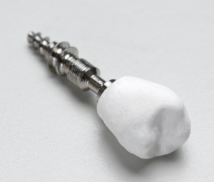 Nanocellulose-based dental implant crown created in VTT lab.