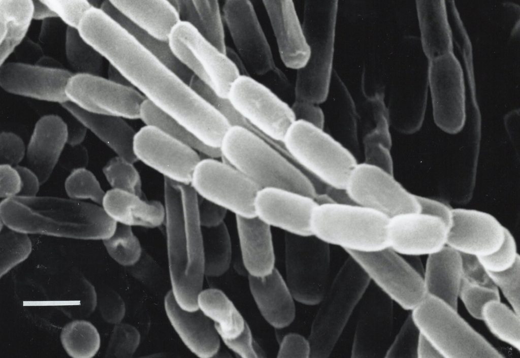 A close-up look at Kitasatospora setae, a bacterium isolated from soil in Japan. These bacteria fix carbon – turn carbon dioxide from their environment into biomolecules they need to survive – thanks to enzymes called ECRs. Researchers are looking for ways to harness and improve ECRs for artificial photosynthesis to produce fuels, antibiotics and other products. 