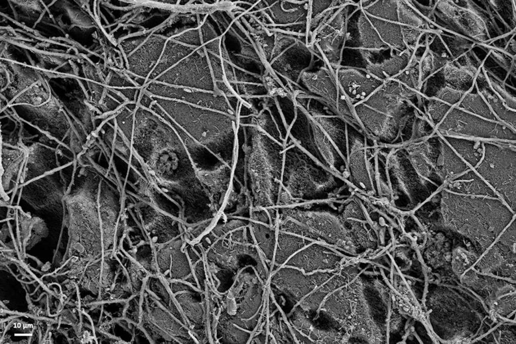 Elektronenmikroskopieaufnahme der Oberfläche eines PBS-​Films nach sechswöchiger Inkubation im Boden: Die Oberfläche des PBS ist durch besiedelte Pilze und Bakterien bereits merklich abgebaut.