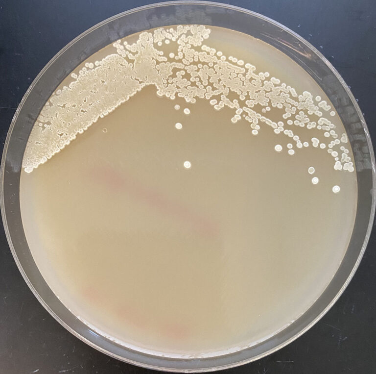 During experiments at DOE’s Joint BioEnergy Institute, researchers observed an engineered strain of the bacteria Streptomyces as it produced cyclopropanes, high-energy molecules that could potentially be used in the sustainable production of novel bioactive compounds and advanced biofuels.