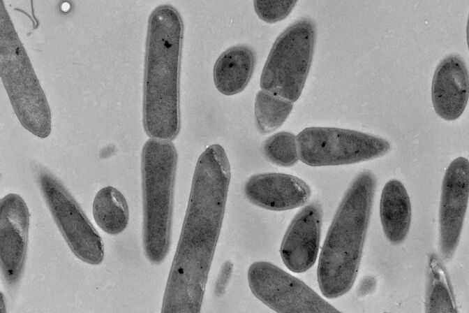 Electron microscope image of the bacterium Clostridium ljungdahlii.