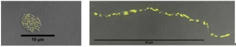 Die Wildtyp-Zellen des Bakteriums Rhodobacter sphaeroides (Abbildung links) wurden mittels der neuen Technik ACIT modifiziert, um die Zellgröße zu erhöhen. In den vergrößerten Zellen (Abbildung rechts) ist gelb die Anhäufung des abgelagerten Energiespeichermoleküls Polyhydroxybutyrat (PHB) sichtbar, das als Grundlage für biologisch abbaubare Kunststoffe dient