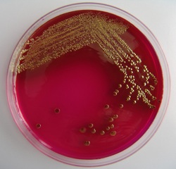 escherichia-coli-1441194-639x614