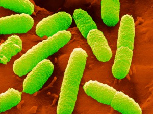  Mikroskopaufnahme von Escherichia coli © Mit freundlicher Genehmigung: Jürgen Berger / MPI für Entwicklungsbiologie 