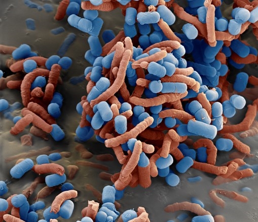 Lactobacillus reuteri (blau) verklumpt und inaktiviert den Magenkeim Helicobacter pylori (rot) – hier 11.000fach vergrößert. © Novozymes A/S