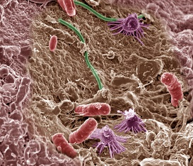 Microbioom-van-de-bodem