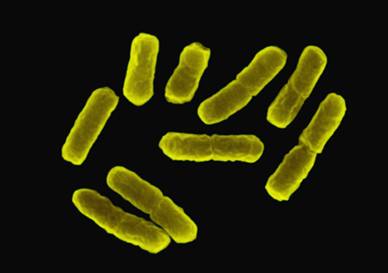 <i/>Escherischia coli”></td>
</tr>
<tr>
<td style=
