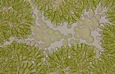 Die Grünalge Botryococcus weist hohe Ölgehalte auf, erkennbar an den hellgrünen Bläschen. 2 Bilder: Uni Wien