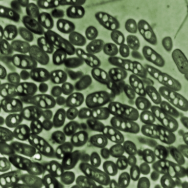 Micrograph shows a group of Ralstonia eutropha bacteria in culture. In their natural <br /></noscript><img class=